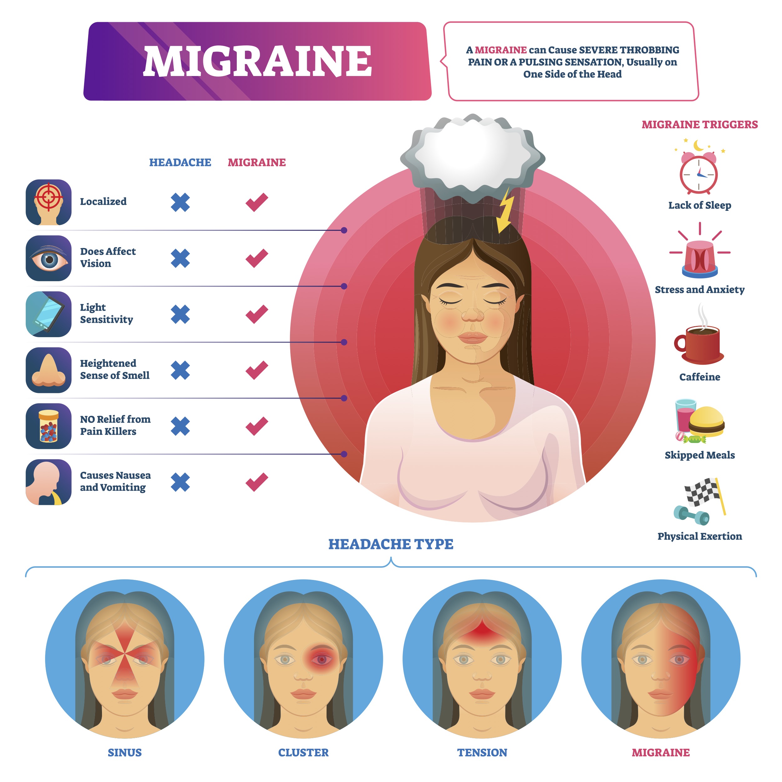 Migraine AppLocum AppLocum